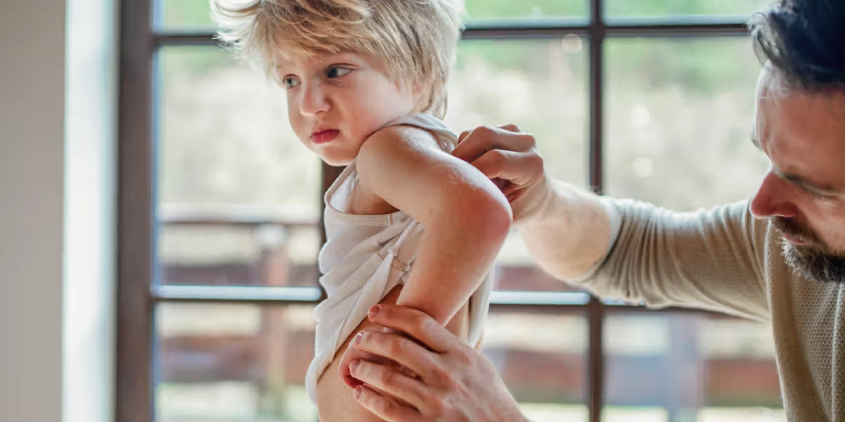 Mold exposure symptoms in kids